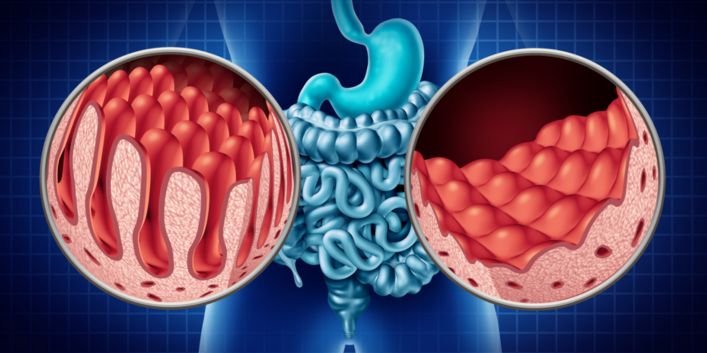Améliorer la peau en améliorant le microbiote