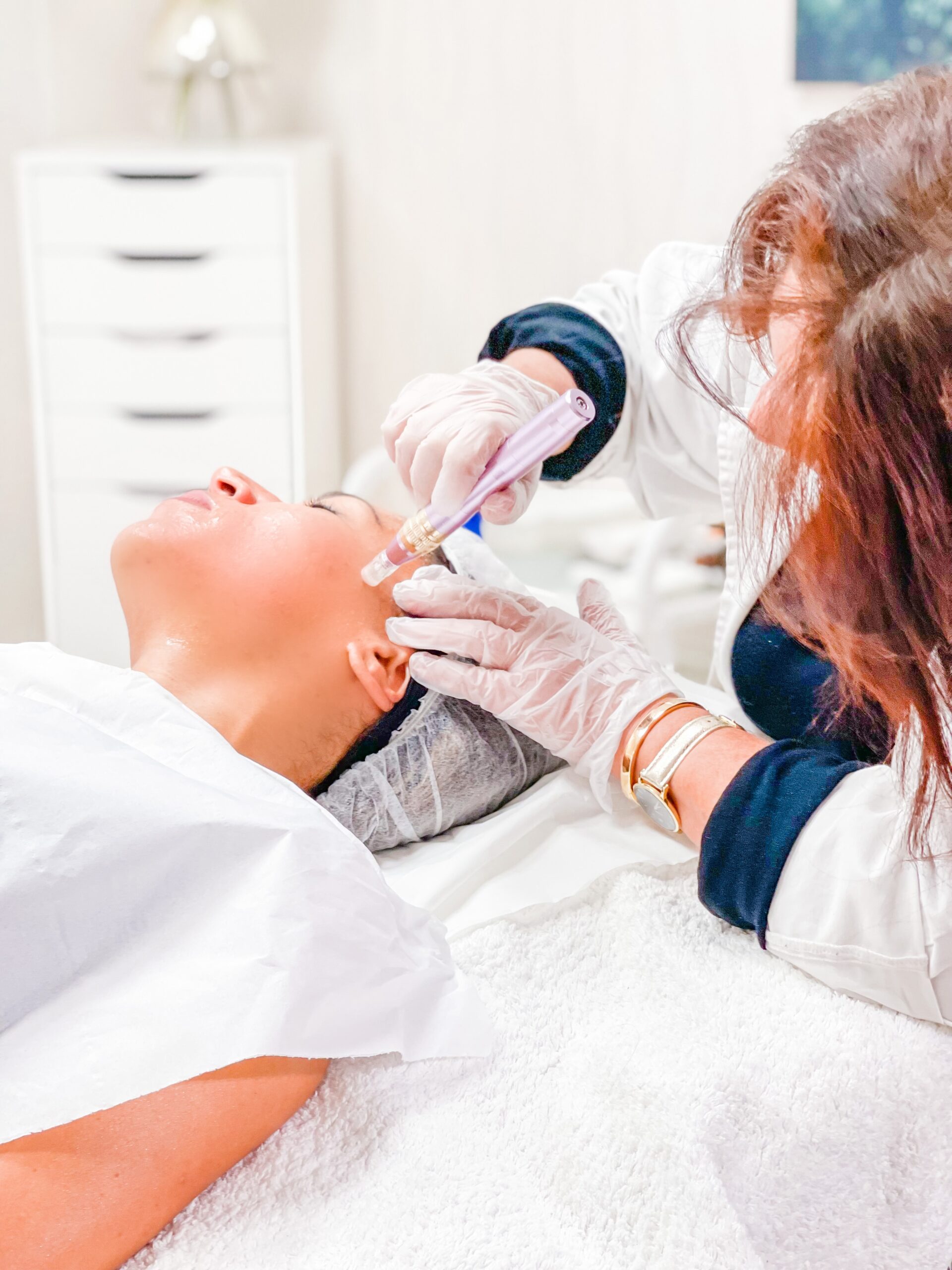 microneedling microneedling