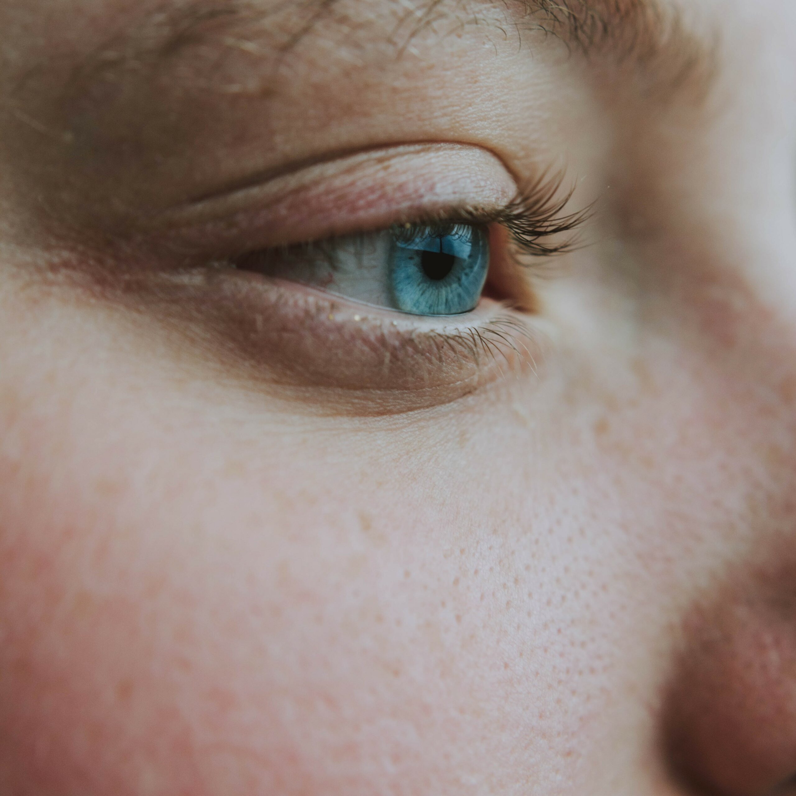 Pores dilatés Femme Pores dilatés Femme