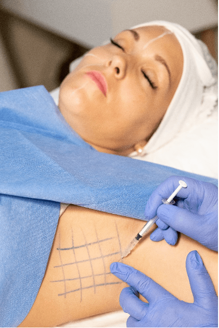 Hyperhidrose Botox Hyperhidrose Botox