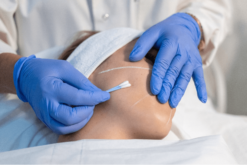 Qu'est-ce qu'un peeling léger Qu'est-ce qu'un peeling léger